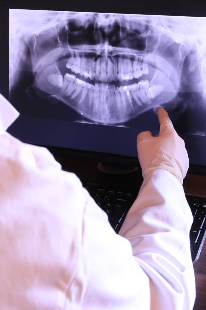 Best After-Hours Dental Trauma Care in Sparta, NC