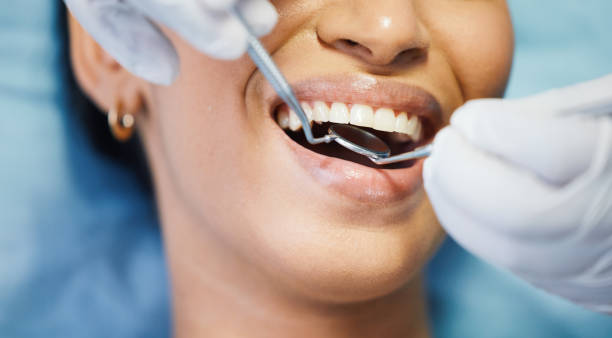 Best Emergency Gum Treatment in Sparta, NC